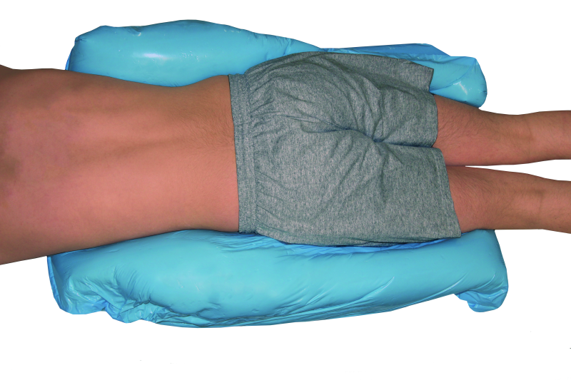 Prostate and Pelvic Immobilization